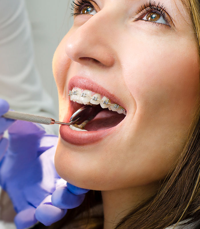 Beautiful girl with dental braces check up